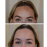 Next Generation LED Therapy Face Mask